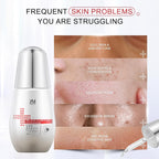 Suero de Niacinamida 10% con Corrector de Manchas Oscuras